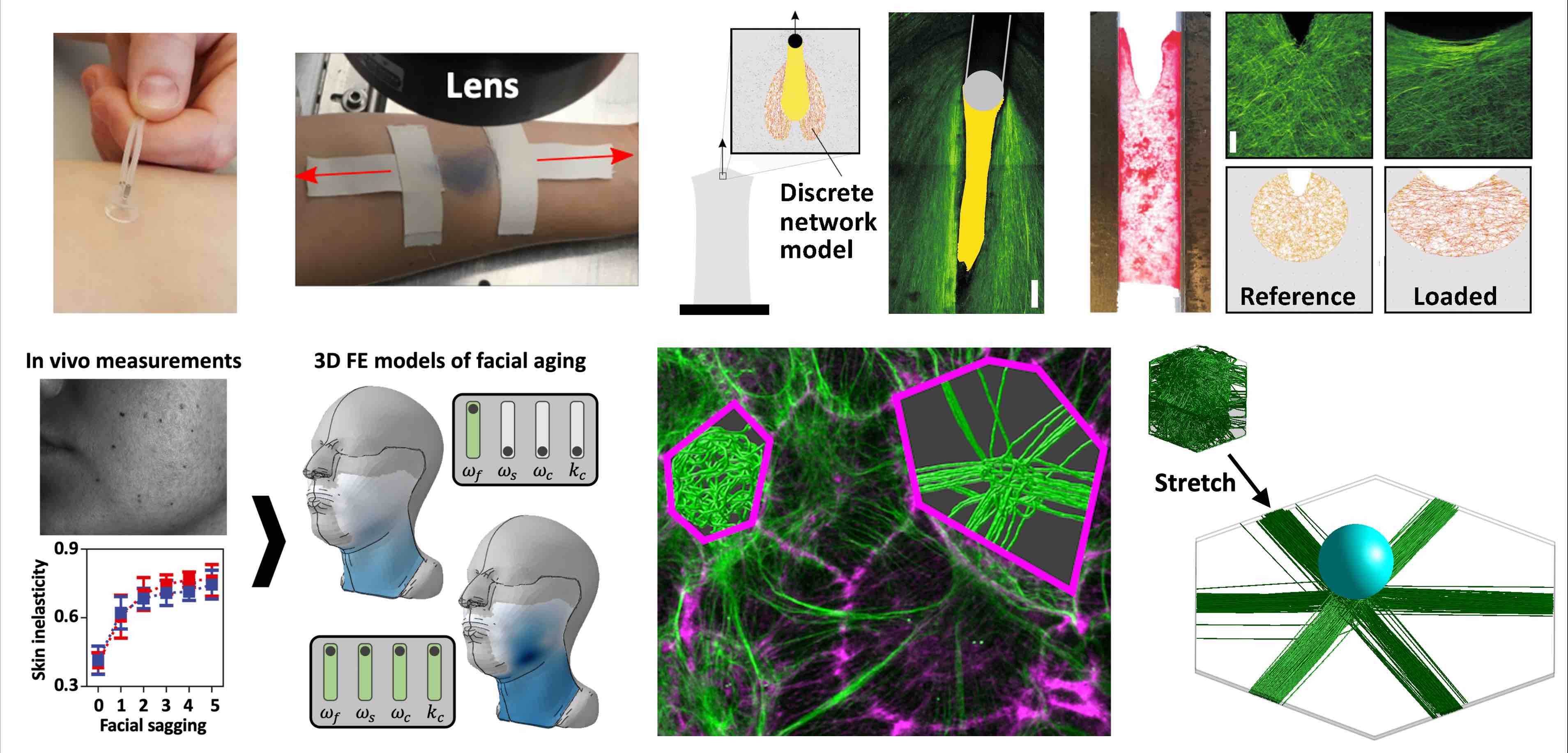 Soft tissue biomechanics