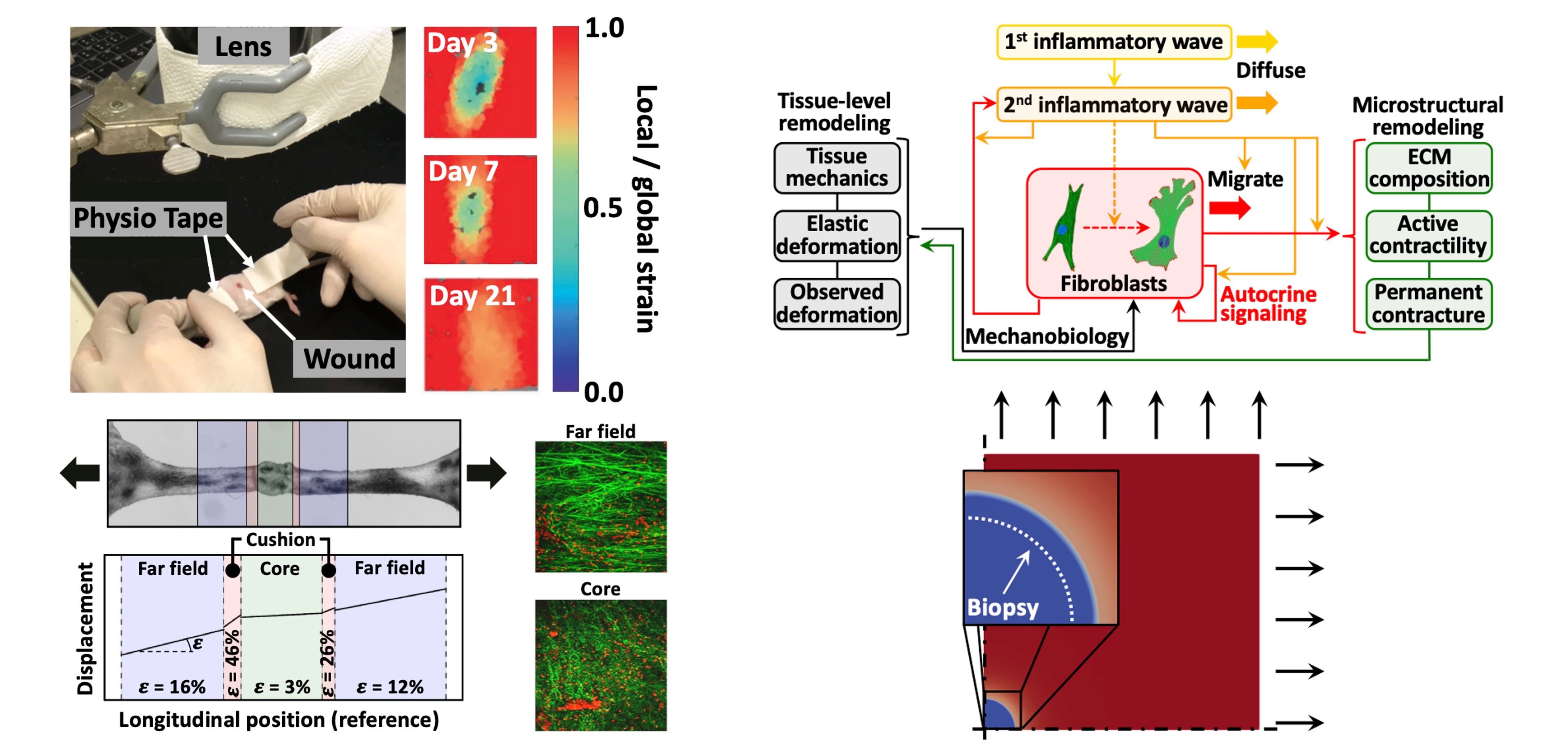 Mechanobiology of scarring