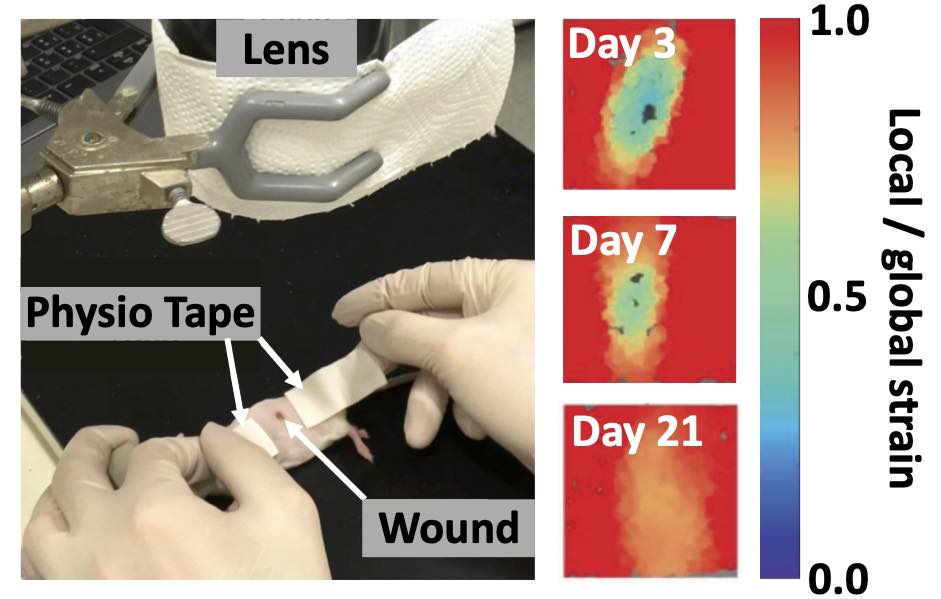 Wound elastography image