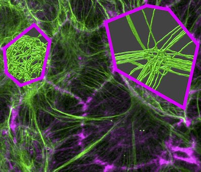 Intermediate filament networks image